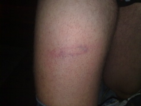 La policia local de Sabadell reté i agredeix diversos veïns