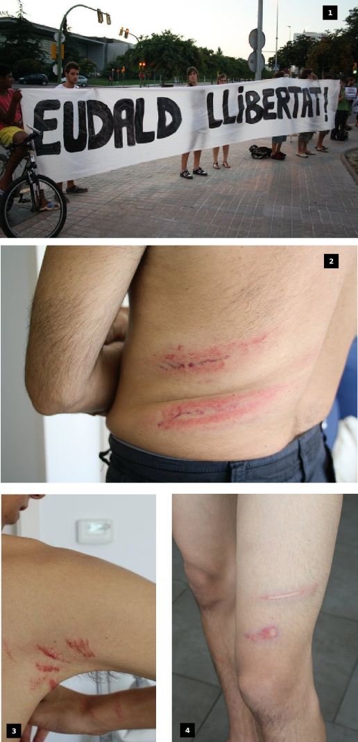 [FOTOS] Es fan públiques les primeres fotografies dels ferits en la càrrega policial de Mataró